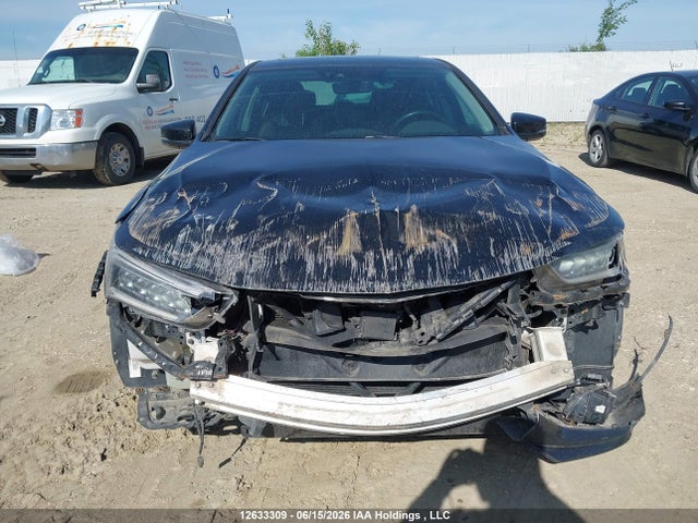 Acura Tlx Elite 2018 19UUB1F77JA800541 Image 13