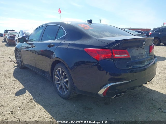 Acura Tlx Elite 2018 19UUB1F77JA800541 Image 3