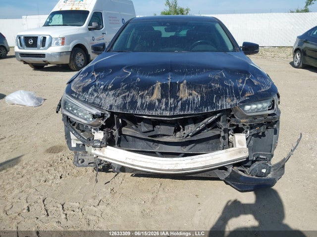 Acura Tlx Elite 2018 19UUB1F77JA800541 Image 6