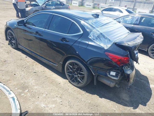 Acura TLX TECH 2017 19UUB3F54HA800100 Image 3