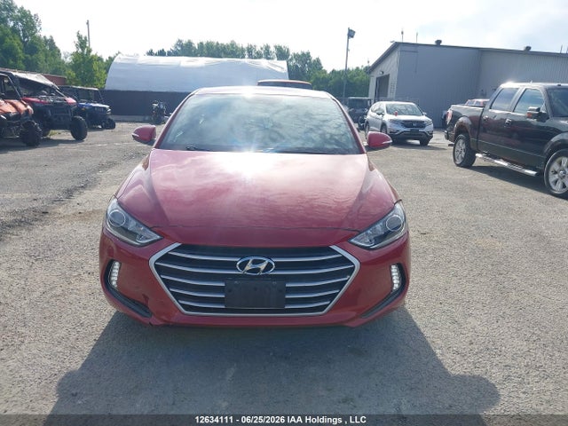 KMHD84LF1JU494196 Hyundai ELANTRA GL