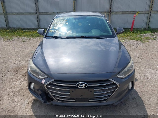 KMHD84LF6JU541318 Hyundai Elantra