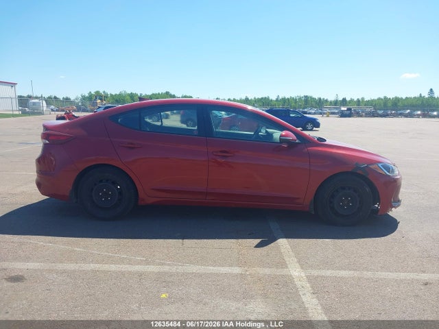 KMHD84LF1JU453633 Hyundai ELANTRA GL