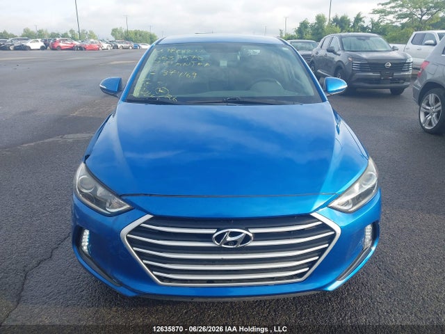 Aukcja sprzedaży 2017 Hyundai Elantra Se/value/limited, vin: KMHD84LF9HU374169, numer aukcji: 12635870