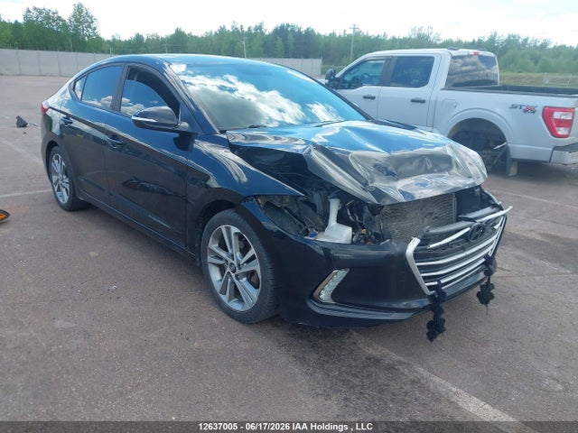 12637005 :رقم المزاد ، KMHD84LF1HU182504 vin ، 2017 Hyundai Elantra Se/value/limited مزاد بيع