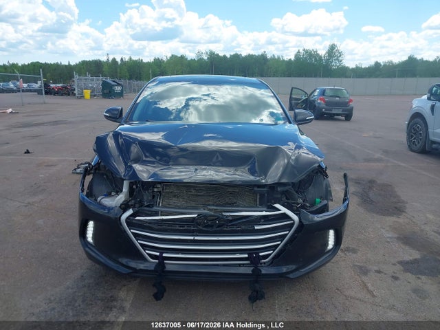 Aukcja sprzedaży 2017 Hyundai Elantra Se/value/limited, vin: KMHD84LF1HU182504, numer aukcji: 12637005