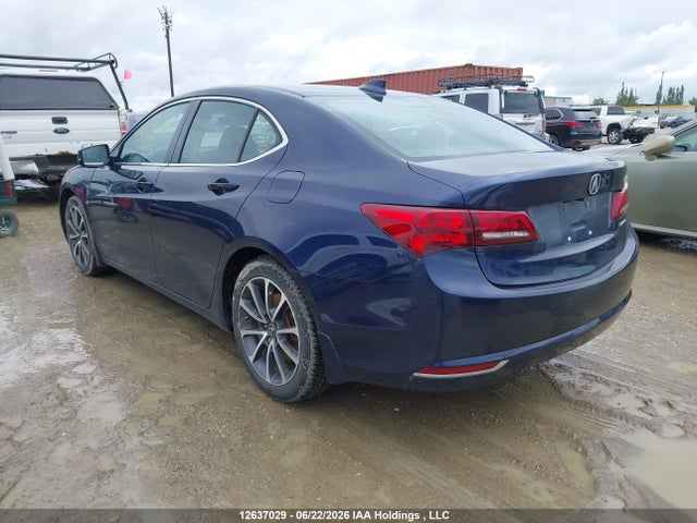 Acura TLX TECH 2016 19UUB3F59GA800916 Image 3