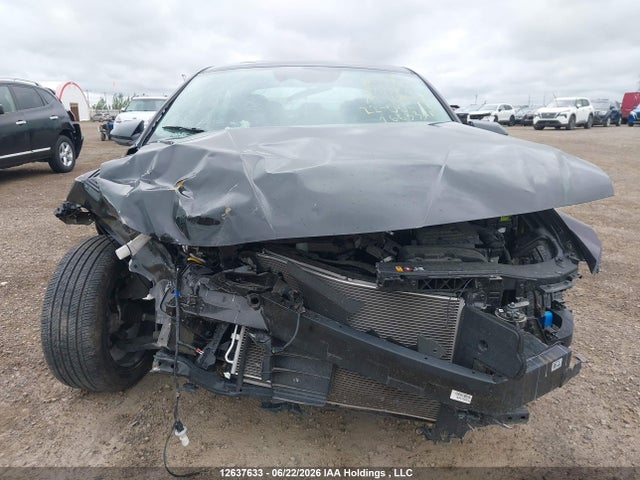 KMHLM4DGXRU666056 Hyundai ELANTRA SEL