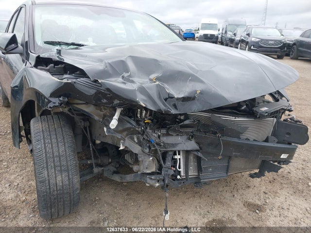 KMHLM4DGXRU666056 Hyundai ELANTRA SEL