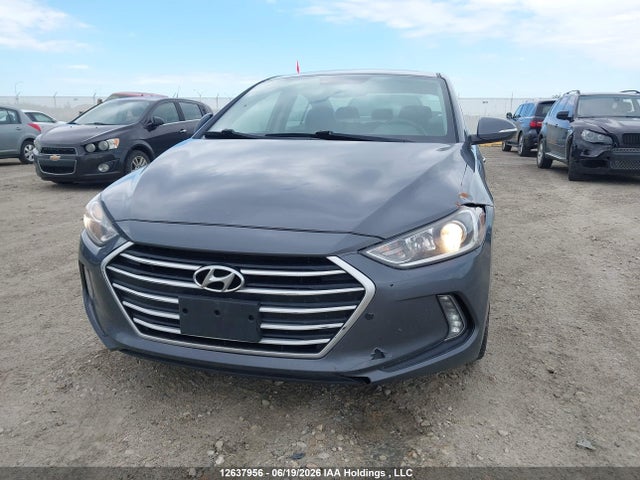 Aukcja sprzedaży 2017 Hyundai Elantra Gls, vin: KMHD84LF0HU191436, numer aukcji: 12637956