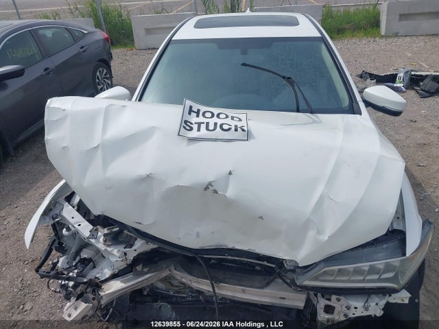 Acura TLX 2015 19UUB1F36FA802138 Image 10