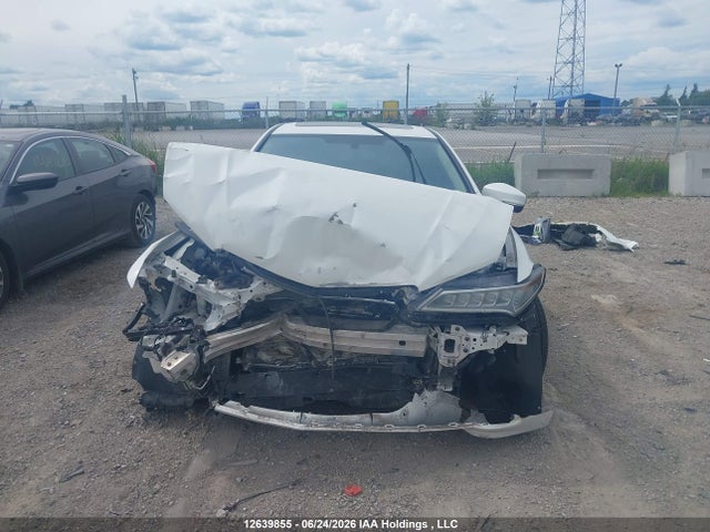 Acura TLX 2015 19UUB1F36FA802138 Image 11