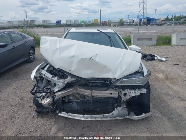 Acura TLX 2015 19UUB1F36FA802138 Image 6