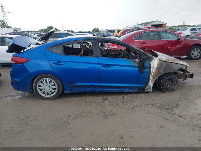 KMHD84LF2HU217776 Hyundai Elantra Gls