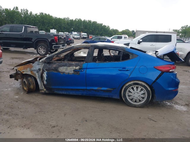 KMHD84LF2HU217776 Hyundai Elantra Gls