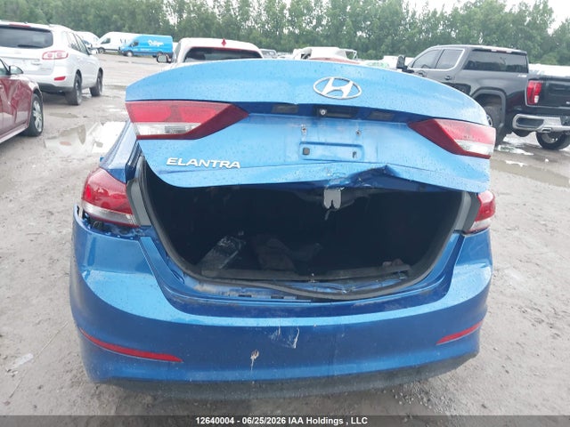 KMHD84LF2HU217776 Hyundai Elantra Gls