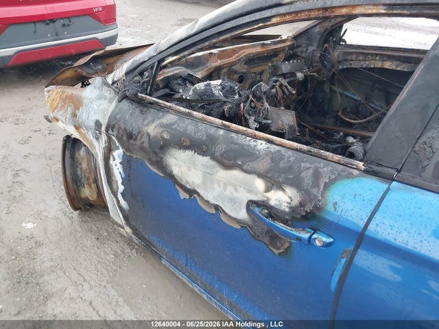 KMHD84LF2HU217776 Hyundai Elantra Gls