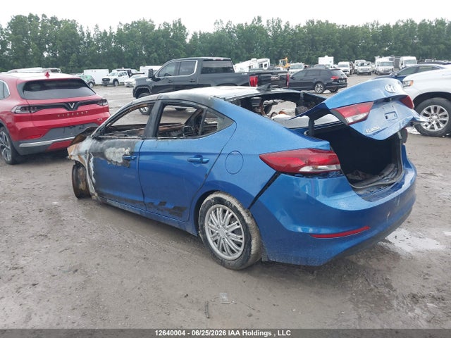 KMHD84LF2HU217776 Hyundai Elantra Gls