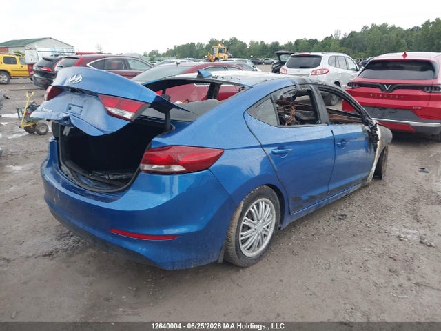 KMHD84LF2HU217776 Hyundai Elantra Gls