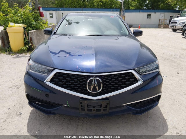 Acura TLX 2018 19UUB1F5XJA800838 Image 12