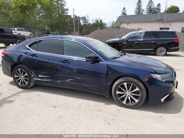 Acura TLX 2018 19UUB1F5XJA800838 Image 13