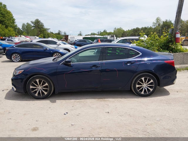 Acura TLX 2018 19UUB1F5XJA800838 Image 14