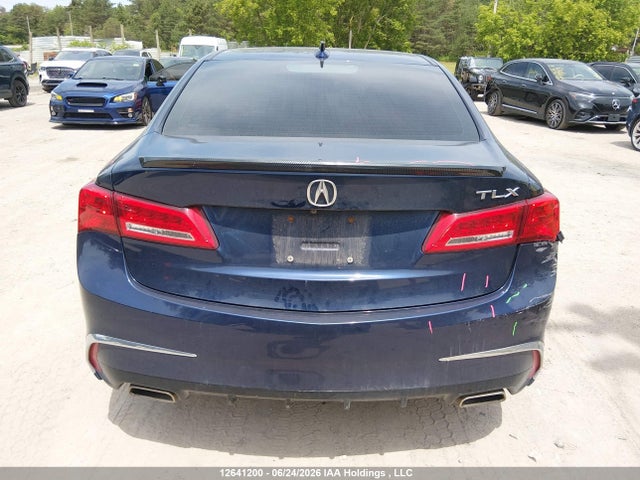 Acura TLX 2018 19UUB1F5XJA800838 Image 16