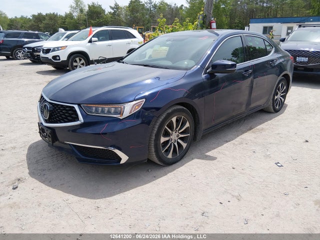 Acura TLX 2018 19UUB1F5XJA800838 Image 2