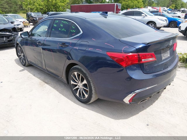Acura TLX 2018 19UUB1F5XJA800838 Image 3