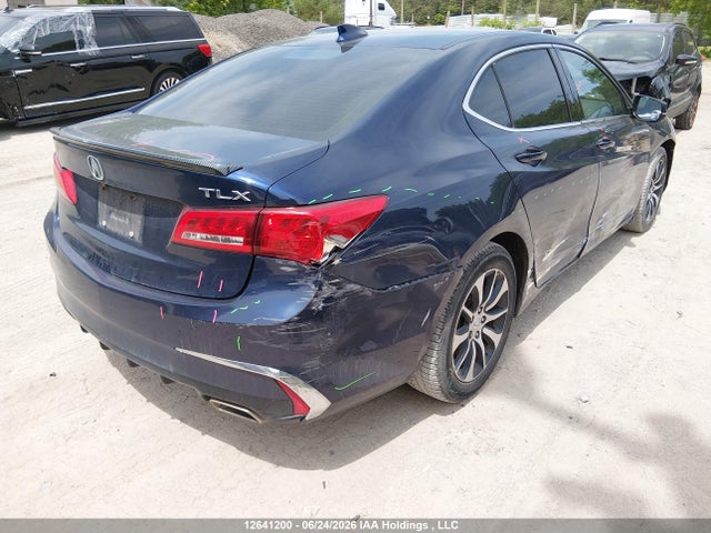 Acura TLX 2018 19UUB1F5XJA800838 Image 4