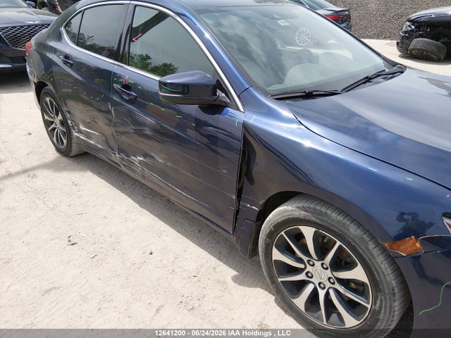 Acura TLX 2018 19UUB1F5XJA800838 Image 6