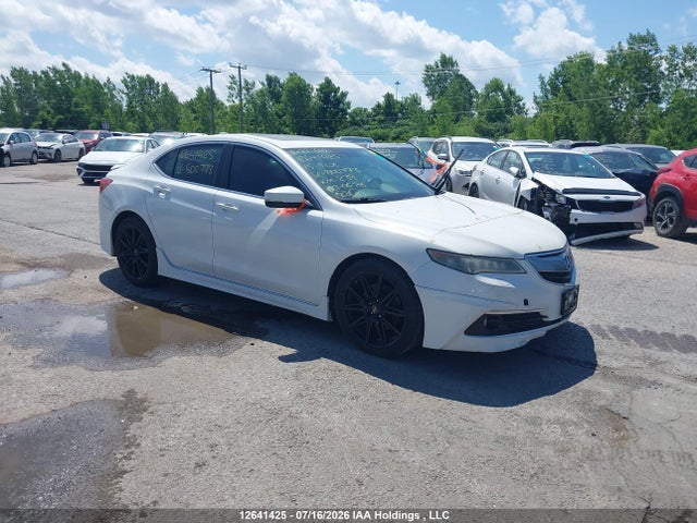 Acura Tlx Elite 2015 19UUB3F72FA800773 Image 1