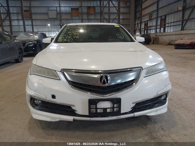 Acura Tlx Elite 2015 19UUB3F72FA800773 Image 13