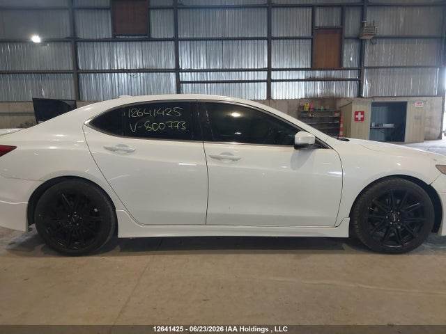 Acura Tlx Elite 2015 19UUB3F72FA800773 Image 14
