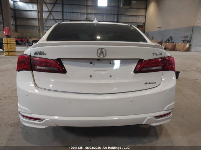 Acura Tlx Elite 2015 19UUB3F72FA800773 Image 17
