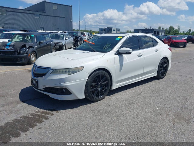 Acura Tlx Elite 2015 19UUB3F72FA800773 Image 2