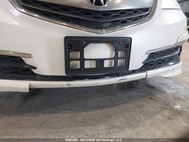 Acura Tlx Elite 2015 19UUB3F72FA800773 Image 21