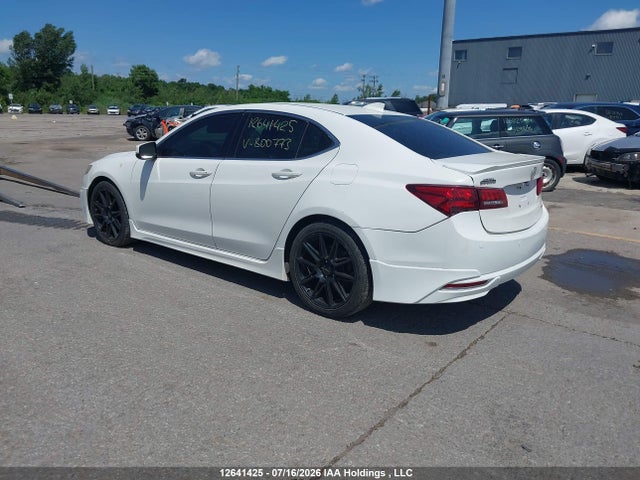 Acura Tlx Elite 2015 19UUB3F72FA800773 Image 3