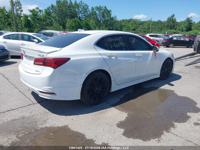 Acura Tlx Elite 2015 19UUB3F72FA800773 Image 4