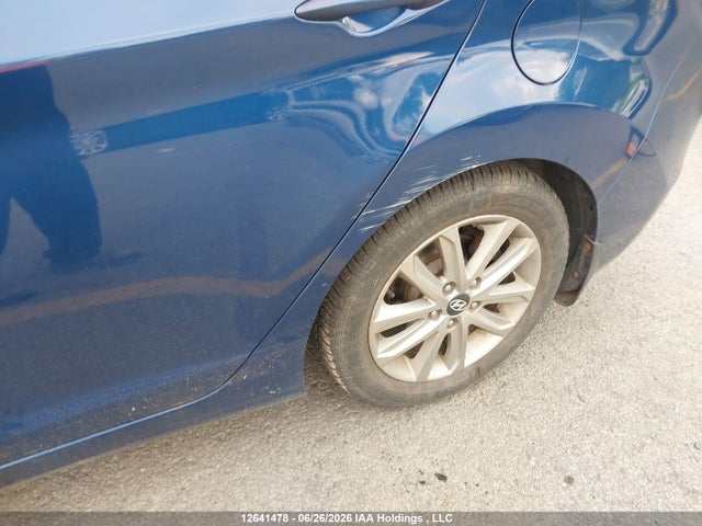 Hyundai Elantra 2015 KMHDH4AE9FU419831 Image 12