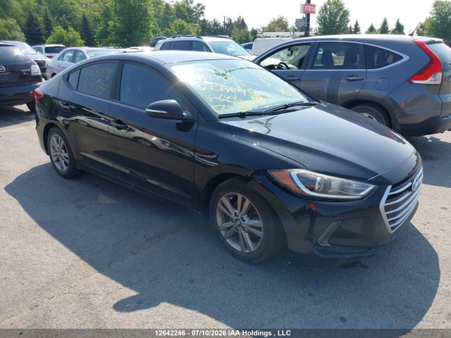 2018 KMHD84LF9JU649688 main image