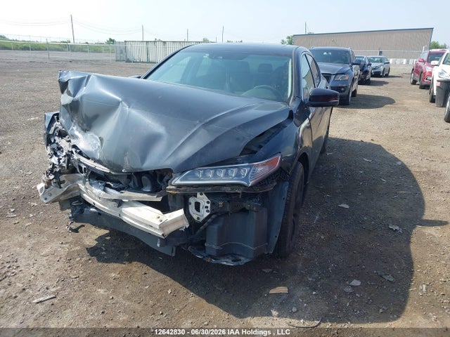 Acura TLX TECH 2016 19UUB1F56GA800179 Image 2