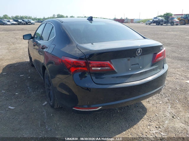 Acura TLX TECH 2016 19UUB1F56GA800179 Image 3