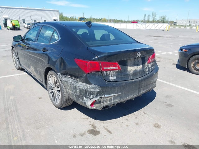 Acura TLX TECH 2020 19UUB3F52LA800783 Image 3