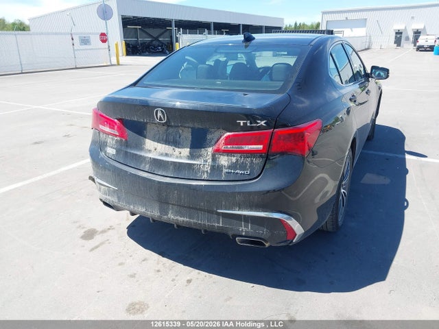 Acura TLX TECH 2020 19UUB3F52LA800783 Image 4