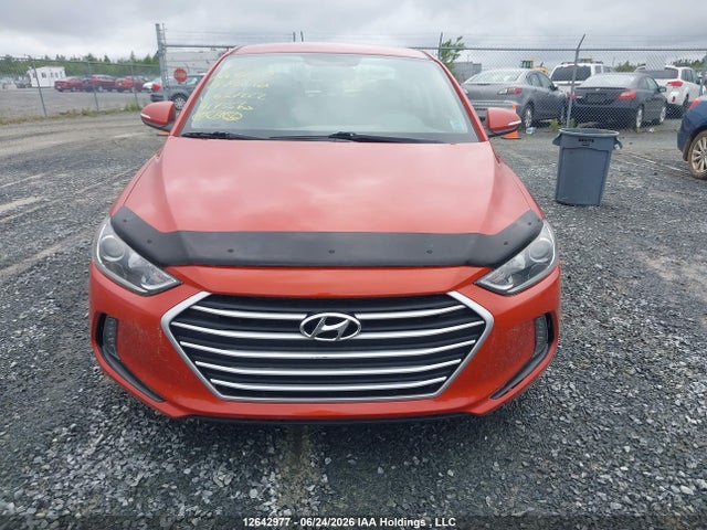 KMHD84LF2JU637222 Hyundai Elantra Sel/value/limited
