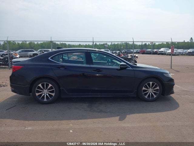 Acura TLX 2015 19UUB1F36FA801507 Image 13