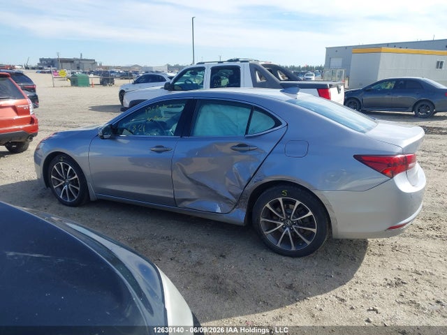 Acura Tlx Elite 2015 19UUB3F76FA803420 Image 13