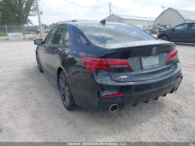 Acura Tlx Elite 2018 19UUB3F8XJA800490 Image 3