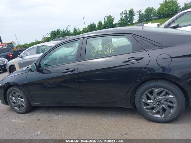 KMHLM4DG2RU706615 Hyundai ELANTRA SEL